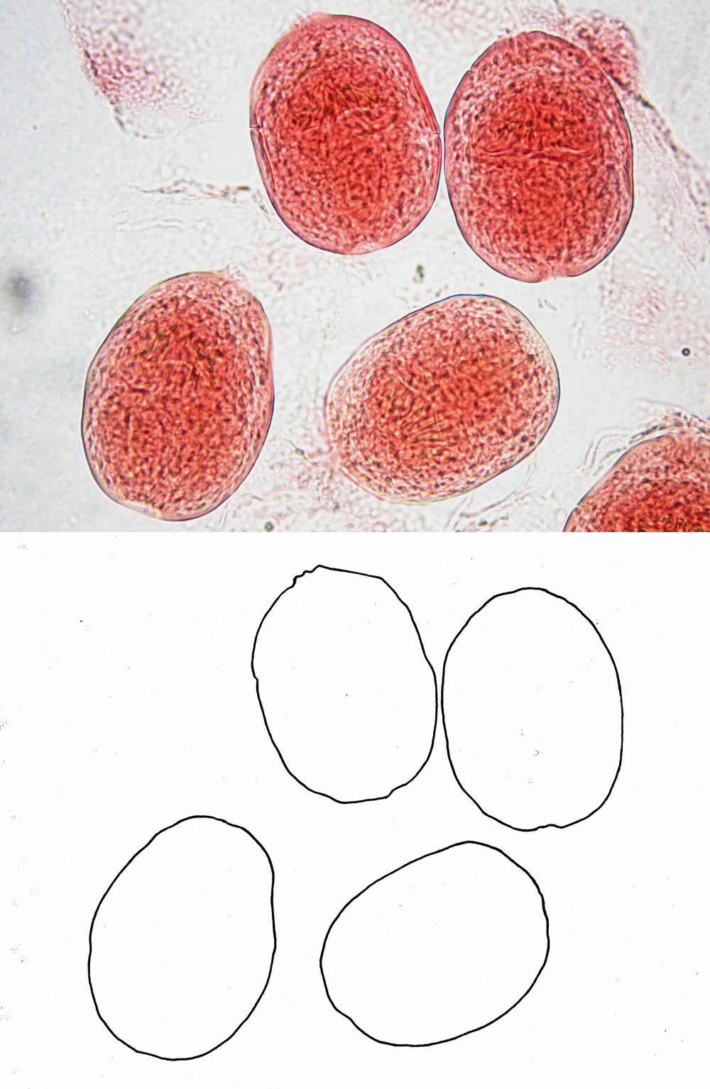 Echinococcus sp.