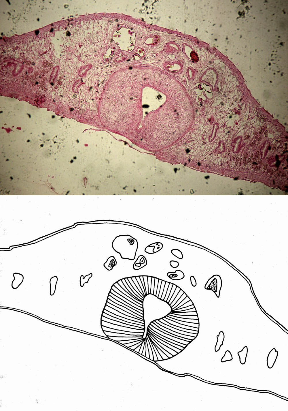 Fasciola hepatica (řez)