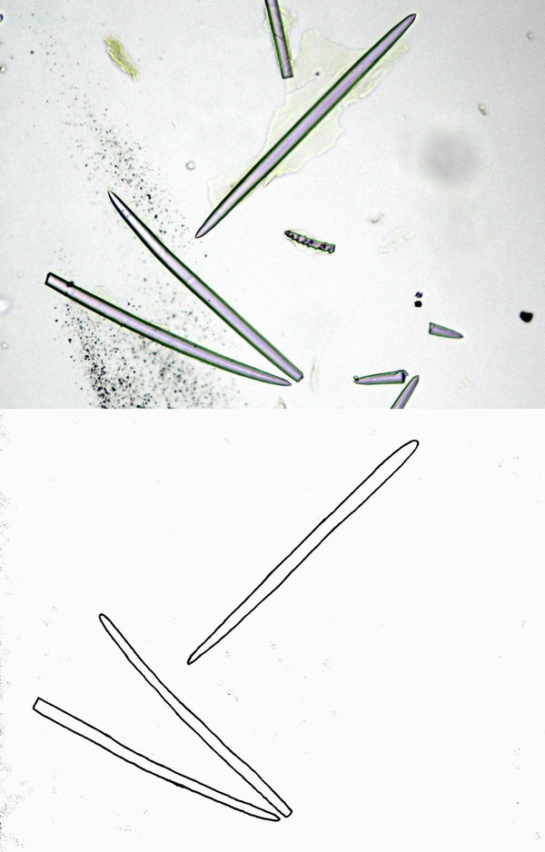 Spongilla lacustris (jehlice)