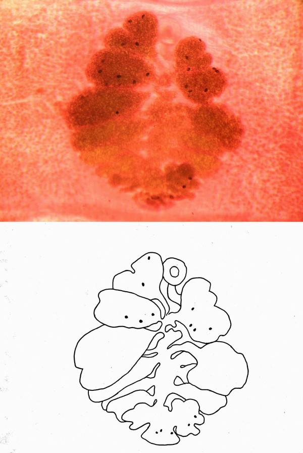 Diphyllobothrium latum (děloha s vajíčky)