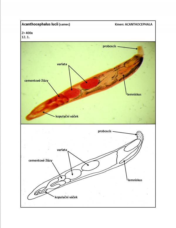 Acanthocephalus lucii (samec)