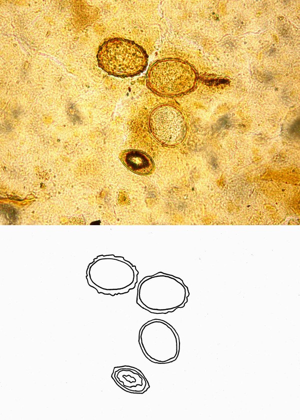 Ascaris lumbricoides (vajíčka)